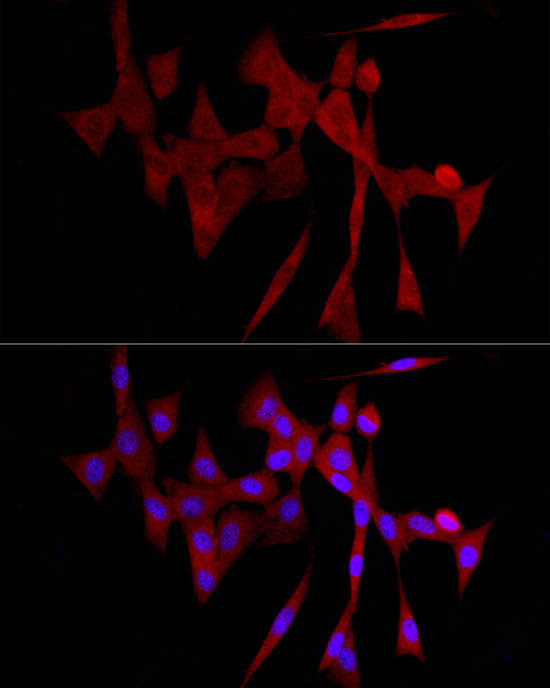 COLGALT1 Rabbit polyclonal antibody