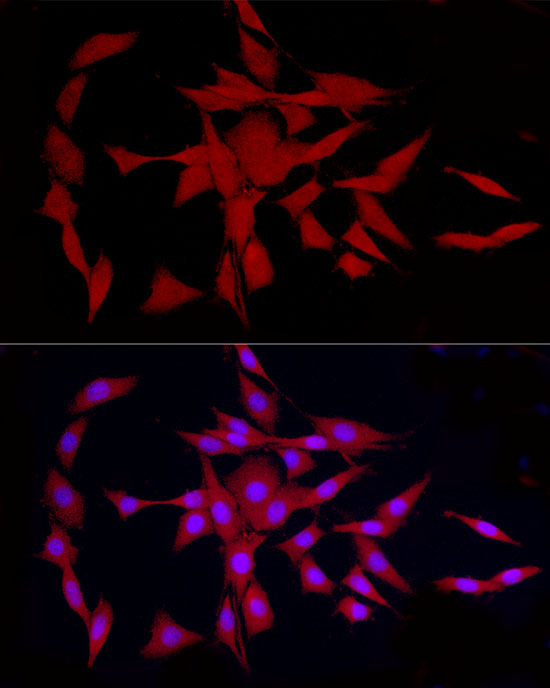 COLGALT1 Rabbit polyclonal antibody
