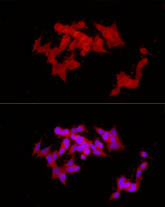 COLGALT1 Rabbit polyclonal antibody