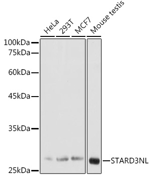 STARD3NL Rabbit polyclonal antibody