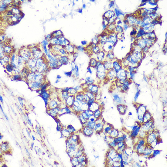 STARD3NL Rabbit polyclonal antibody