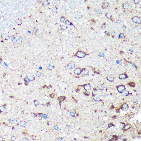 STARD3NL Rabbit polyclonal antibody