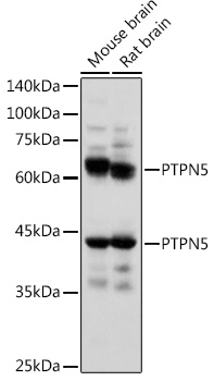 PTPN5 Rabbit polyclonal antibody