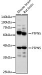 Western blot - PTPN5 Rabbit pAb (A16585)