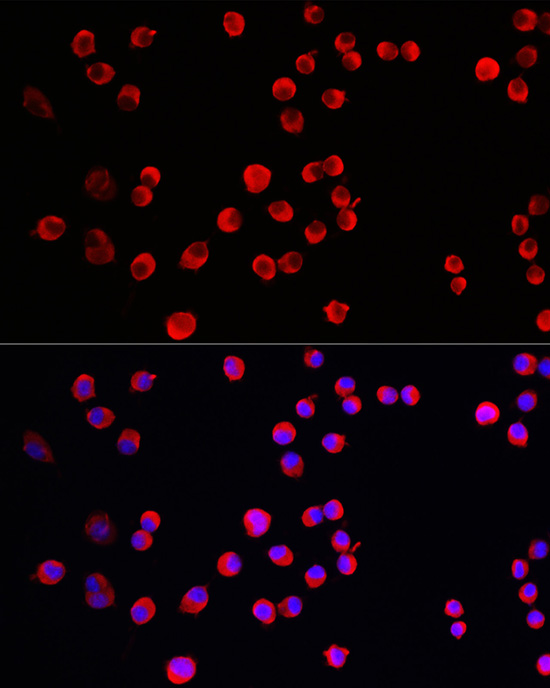 PTPN5 Rabbit polyclonal antibody