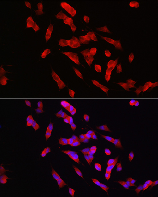 PTPN5 Rabbit polyclonal antibody