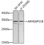 Western blot - ARHGAP11B Rabbit pAb (A16587)