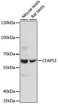 CFAP53 Rabbit polyclonal antibody