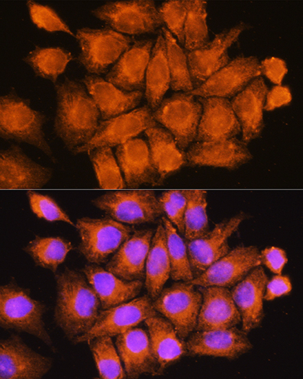 CFAP53 Rabbit polyclonal antibody