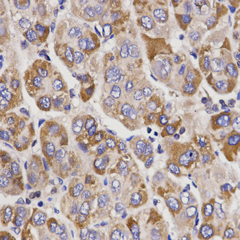 UGT1A9 Rabbit polyclonal antibody