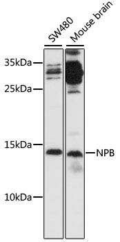 NPB Rabbit polyclonal antibody