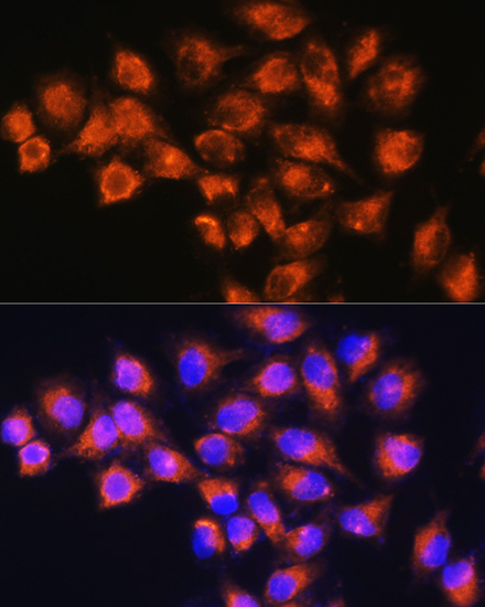 NPB Rabbit polyclonal antibody