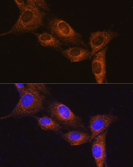 NPB Rabbit polyclonal antibody