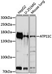 Western blot - ATP11C Rabbit pAb (A16616)