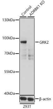 [KO Validated] GRK2 Rabbit polyclonal antibody