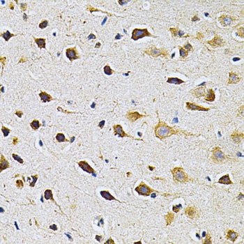 [KO Validated] GRK2 Rabbit polyclonal antibody