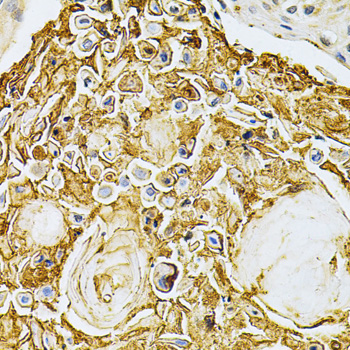 [KO Validated] GRK2 Rabbit polyclonal antibody