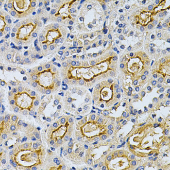 [KO Validated] GRK2 Rabbit polyclonal antibody
