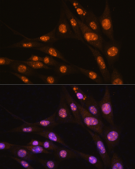YY2 Rabbit polyclonal antibody