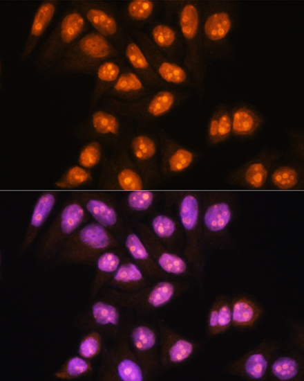 YY2 Rabbit polyclonal antibody