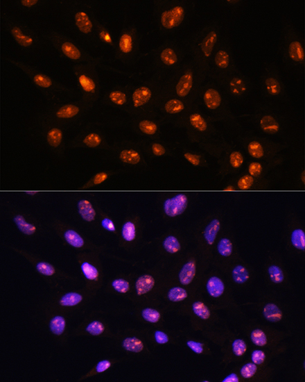 YY2 Rabbit polyclonal antibody