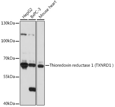 Human Thioredoxin Reductase 1/TRXR1 Rabbit polyclonal antibody