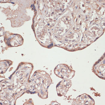 Human Thioredoxin Reductase 1/TRXR1 Rabbit polyclonal antibody