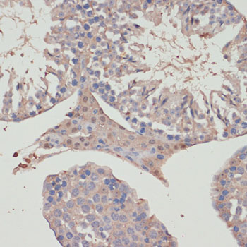 Human Thioredoxin Reductase 1/TRXR1 Rabbit polyclonal antibody