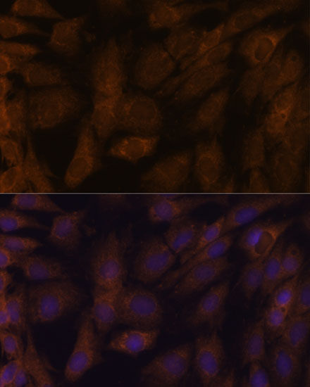 Human Thioredoxin Reductase 1/TRXR1 Rabbit polyclonal antibody
