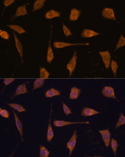 Human Thioredoxin Reductase 1/TRXR1 Rabbit polyclonal antibody
