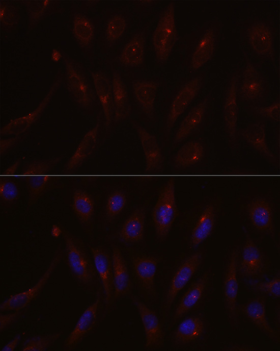 PCM1 Rabbit polyclonal antibody