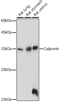 Calponin Rabbit polyclonal antibody
