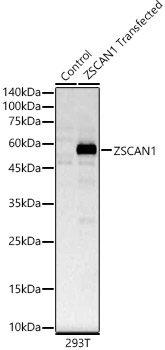ZSCAN1 Rabbit polyclonal antibody