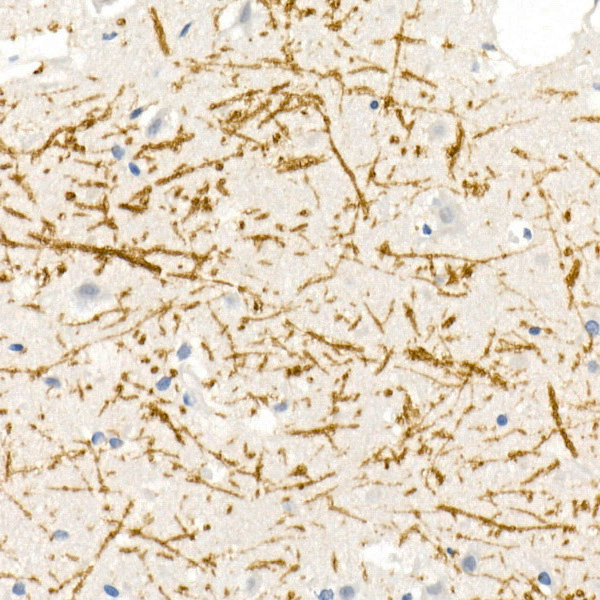 Myelin Basic Protein Rabbit polyclonal antibody