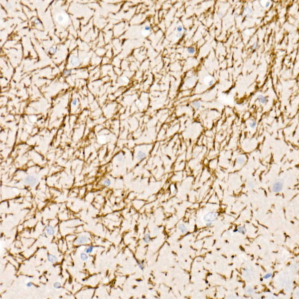 Myelin Basic Protein Rabbit polyclonal antibody