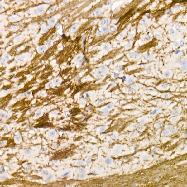 Myelin Basic Protein Rabbit polyclonal antibody