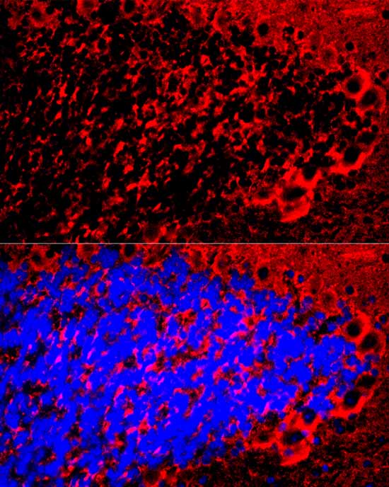 Myelin Basic Protein Rabbit polyclonal antibody