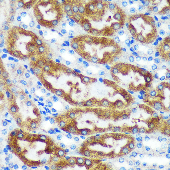 [KO Validated] CHCHD2 Rabbit polyclonal antibody