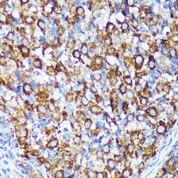 [KO Validated] CHCHD2 Rabbit polyclonal antibody