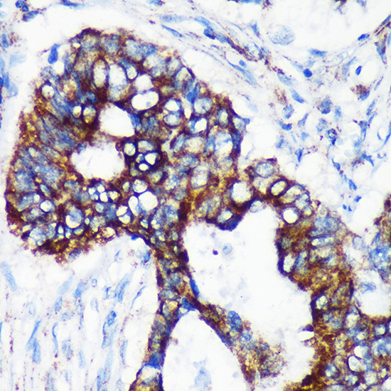 [KO Validated] CHCHD2 Rabbit polyclonal antibody