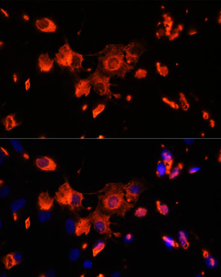 VPS18 Rabbit polyclonal antibody