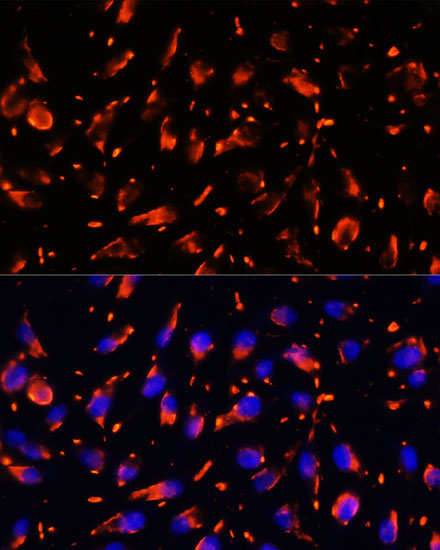 VPS18 Rabbit polyclonal antibody