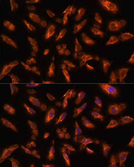 VPS18 Rabbit polyclonal antibody
