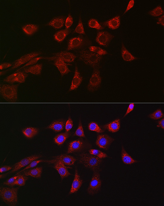 DRP1 Rabbit polyclonal antibody