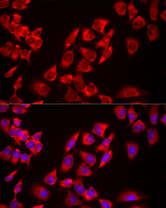 USP21 Rabbit polyclonal antibody