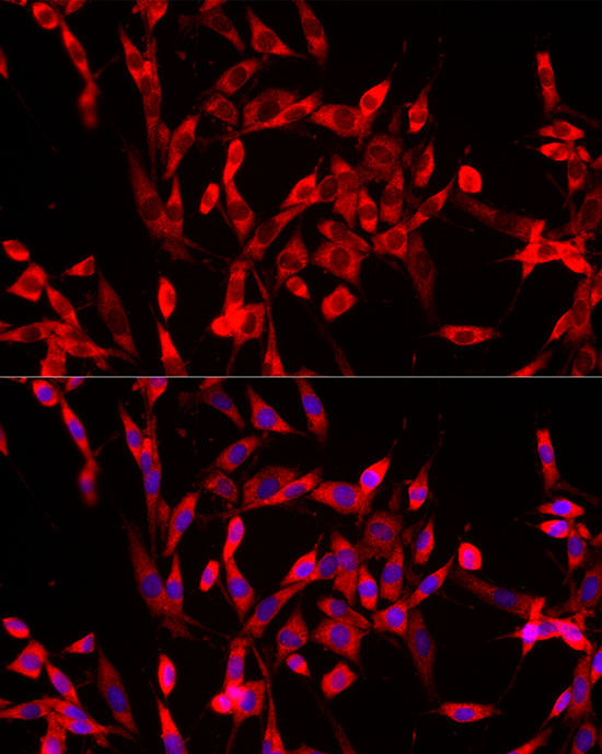 USP21 Rabbit polyclonal antibody