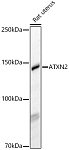 Western blot - ATXN2 Rabbit pAb (A16666)