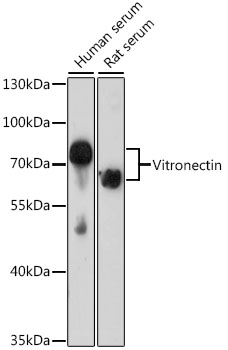 Vitronectin Rabbit polyclonal antibody