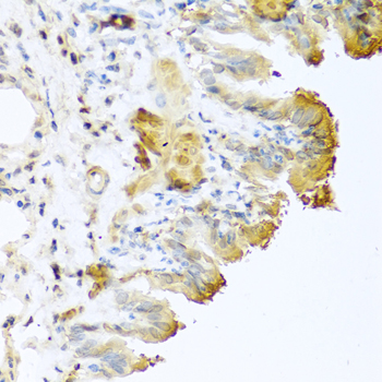 Vitronectin Rabbit polyclonal antibody