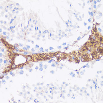 Vitronectin Rabbit polyclonal antibody